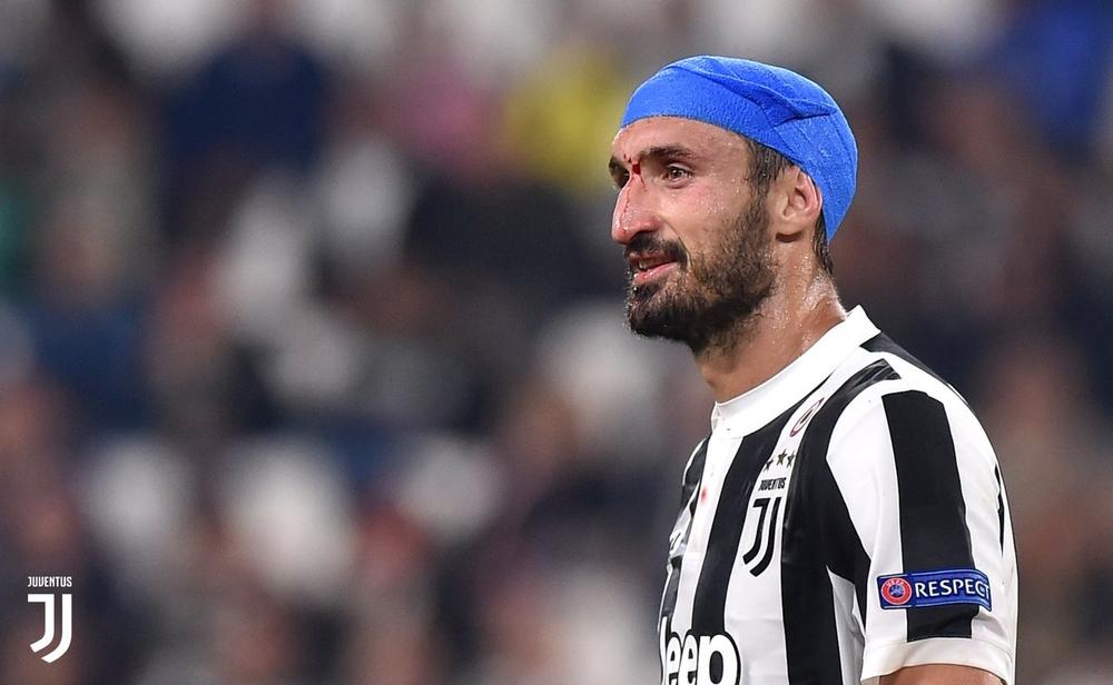 كيليني يستجيب لمبادرة ماتا بالتبرع بـ1% من راتبه