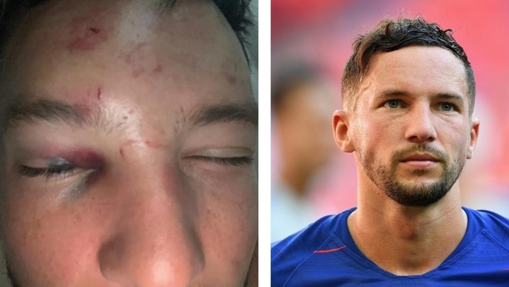 "اكسروا قدمه" .. اعتداء "وحشي" على الإنجليزي درينكووتر