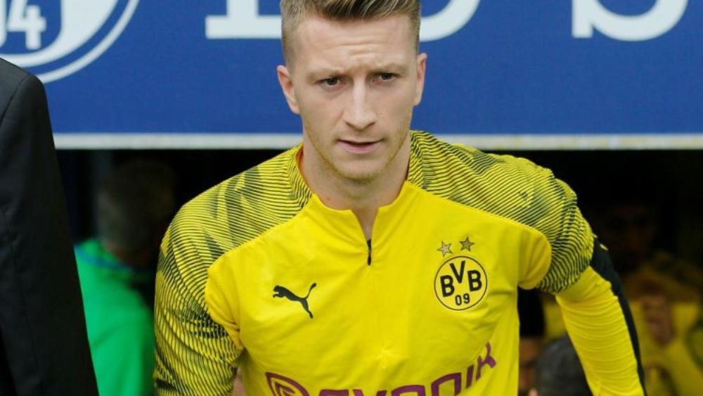 رويس يحاول اللحاق بمباراة الإنتر في دوري الأبطال