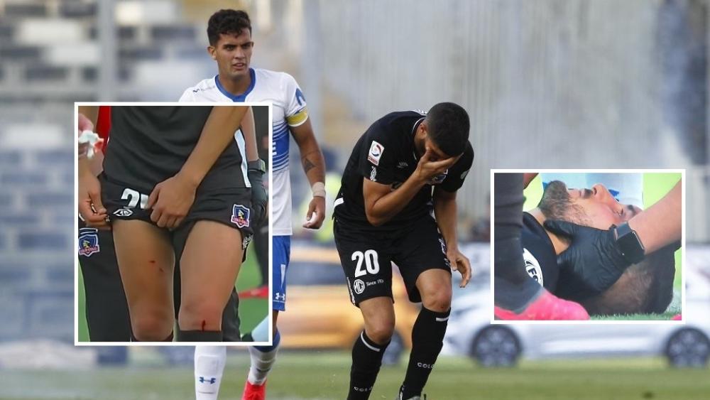إيقاف "قمة" الدوري التشيلي بعد إصابة لاعب بـ"الألعاب النارية"!