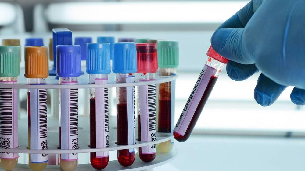 وزارة الصحة: "استبعاد 214 شخصاً في الـ24 ساعة الأخيرة بعد خضوعهم لتحاليل مخبرية أكَّدت عدم إصابتهم بوباء كورونا"