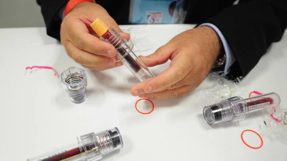 العصبة الاحترافية تدعو رؤساء الأندية الوطنية لتسهيل عمل "لجان" مكافحة المنشطات