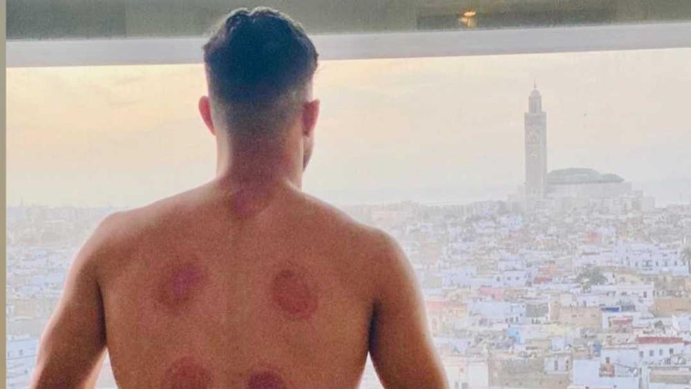 يحيى جبران يلجأ لـ"الحجامة" استعدادا للموسم الجديد