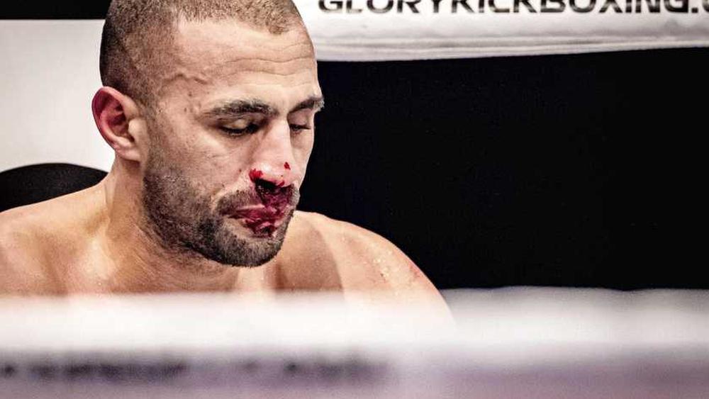 بدر هاري يتعرض لكسر في الأنف أثناء التدريب ومنظمة "غلوري" تؤجل نزاله أمام البولندي "أركاديوس جوسيك" إلى شتنبر المقبل