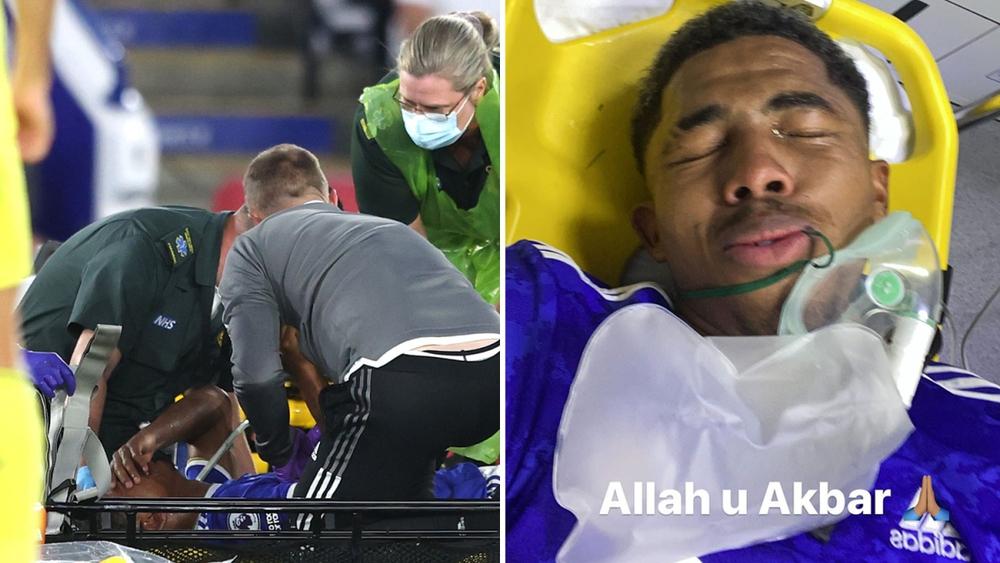 لاعب ليستر سيتي "فوفانا" يتعرض لتدخل "قوي" في مباراة ودية يبعده عن الملاعب لعدة أشهر!