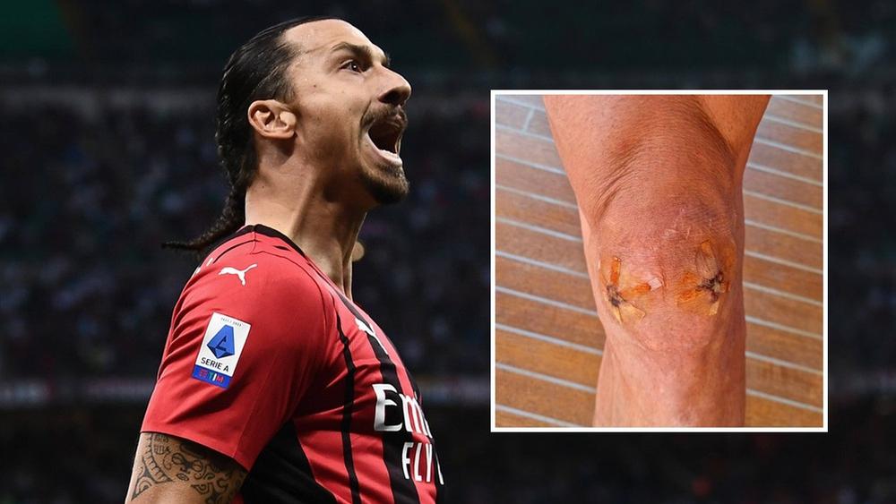 إبراهيموفيتش قبل 20 يوما من بلوغ 40 سنة.. خضع لعملية جراحية قبل 4 أشهر عاد وسجل ضد لاتسيو