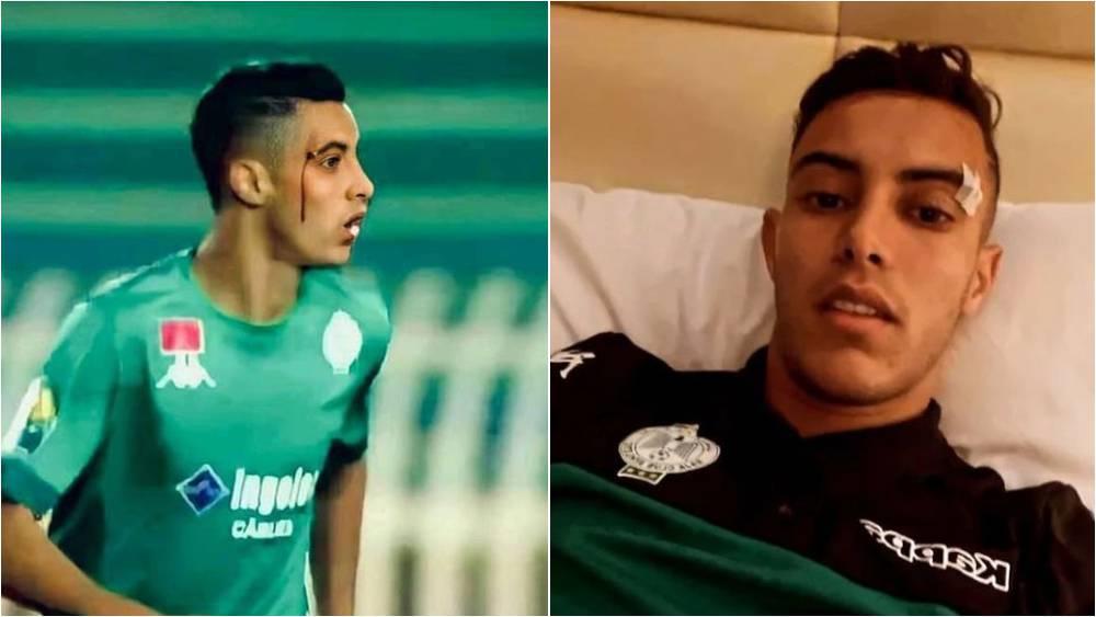 الوردي حاضر رفقة الرجاء أمام الشباب السالمي وإصابته لا تدعو للقلق