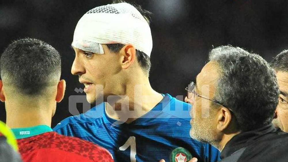 متأثراً بالإصابة.. بونو يضطر لمغادرة مباراة المغرب والكونغو في شوطها الأول والمحمدي يُعوّضه