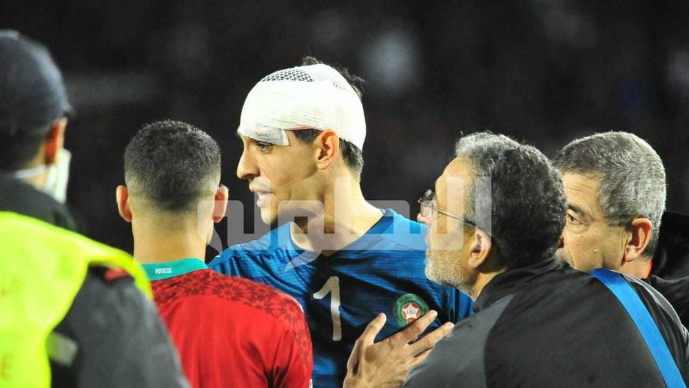 بونو يسعى للِّحاق بمباراة إشبيلية وبرشلونة الأحد القادم في "الليغا"