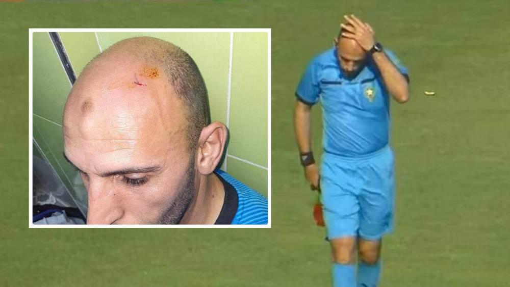 إصابة حكم الشرط تُوقف مباراة سريع واد زم والرجاء