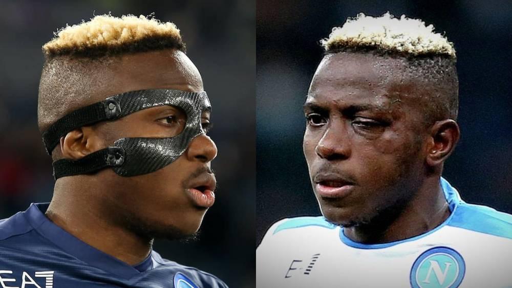 أوسيمين: "شعرت وكأن إصابتي كانت قاتلة.. لم أستطع النوم ولا حتى تناول الطعام بسبب الألم"