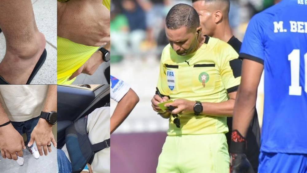 الحكم رضوان جيد يتعرض لكسر بعد إصابته أثناء قيادته لمواجهة الرجاء والجيش الملكي