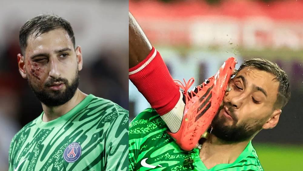 دوناروما عن الندبة في وجهه: "أنا أسد وأهم شيء هو عدم تجاوز الكرة خط المرمى"