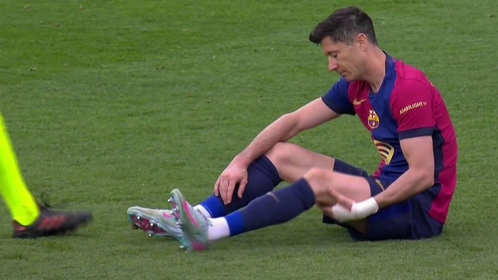 ليفاندوفسكي يصاب قبل أسبوع من نهائي كأس الملك ضد ريال مدريد