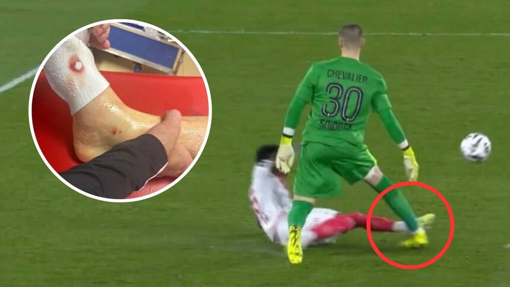 Lucas Chevalier (PSG) : « Ma carrière aurait pu prendre un autre tournant à cause de ce tacle, mais j'ai eu de la chance »