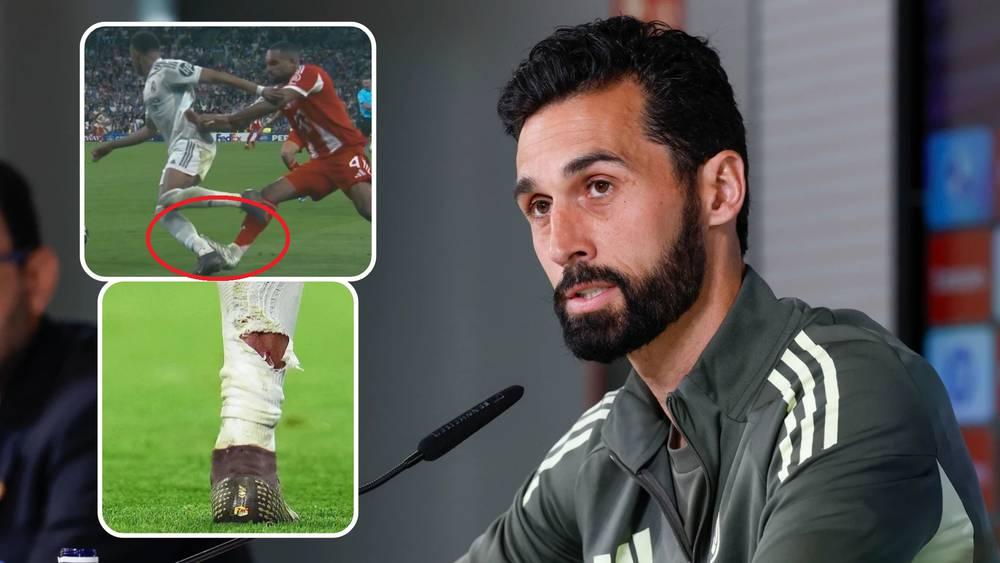 أربيلوا: "يصعب فهم لماذا لم يشهر الحكم بطاقة حمراء بعد التدخل على مبابي.. يجب إصلاح التحكيم"