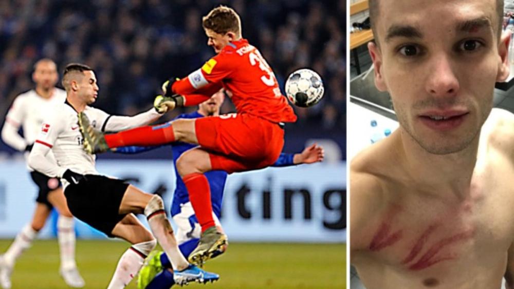 الاتحاد الألماني يعلن إيقاف حارس شالكه لـ "4 مباريات"