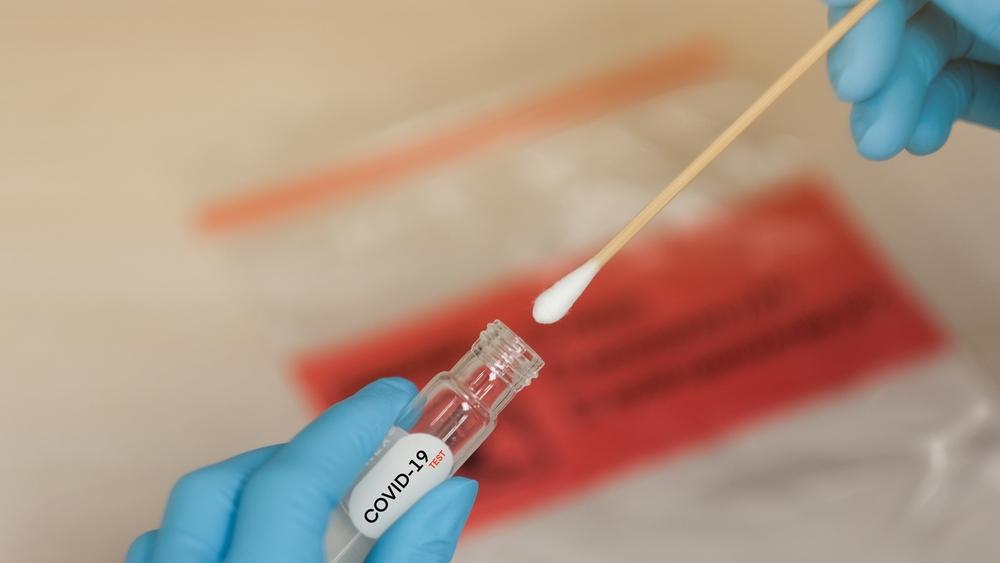 المغرب يسجل 118 حالة من أصل 8412 تحليلا مخبريا في آخر 16 ساعة بنسبة إصابة تصل إلى %1.4