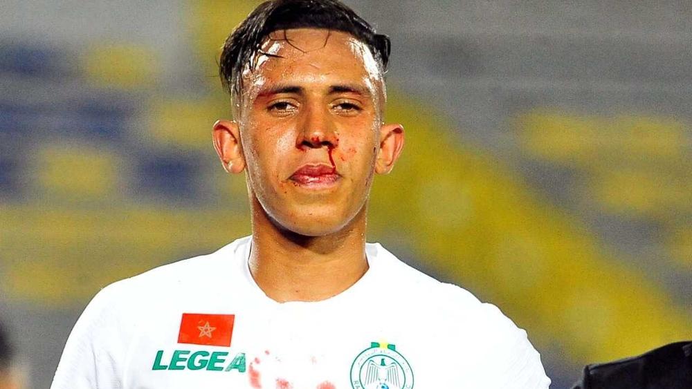 عملية جراحية ناجحة لرحيمي بعد إصابته في الأنف.. وعودته للتداريب حُدّدت في يوم الأربعاء القادم