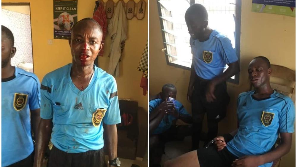 مشجعو نادٍ غاني بدوري الدرجة الثانية يعتدون على الطاقم التحكيمي لمباراتهم ويُخلِّفون جروحاً ودماءً في صفوفهم