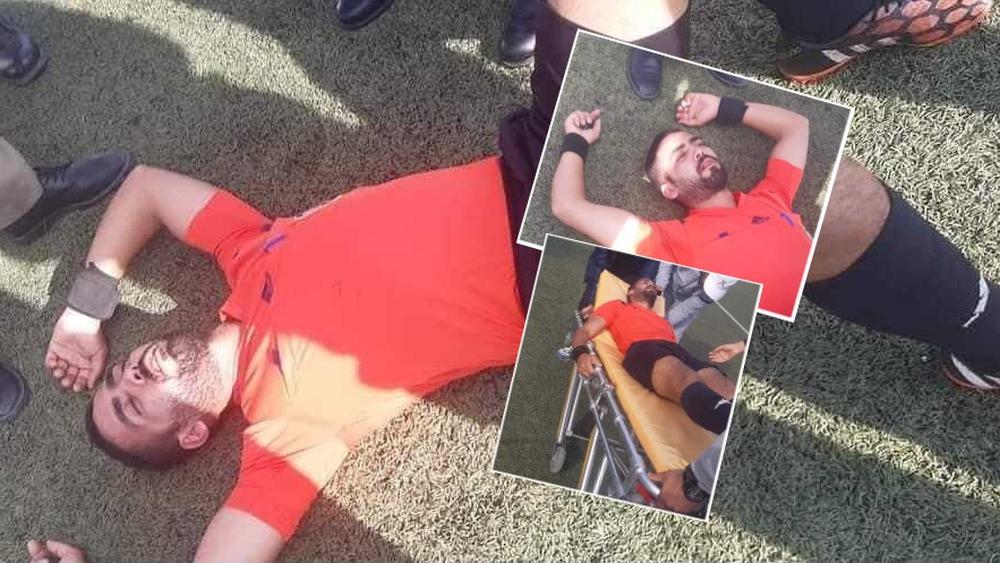 في مشهد "لا رياضي" بقسم الهواة.. الحكم بوعدلية يتعرض لاعتداء على مستوى الرأس والأسنان من طرف أحد لاعبي رجاء زواغة