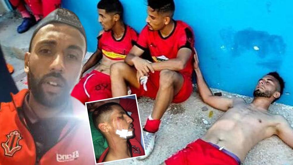 عميد الاتحاد القاسمي لـ"البطولة" بعد اعتداءَات الداخلة: "هضَرت مع الحكمْ وقاليّا نعوضُوكم فماتشْ آخر!"