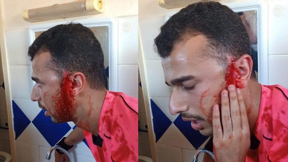 اعتداء "خطير" على حكم مباراة وداد تيفلت وكواكب القنيطرة