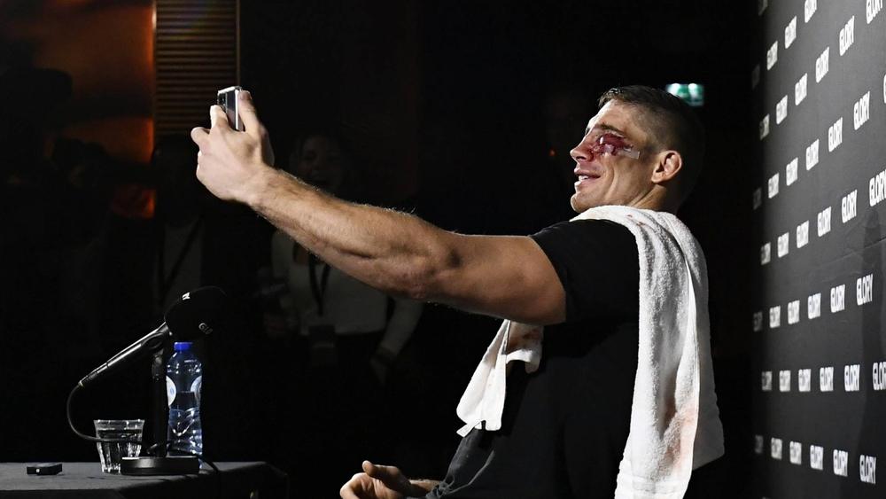 ريكو: "بن صديق قام بعمل رائع.. إصابتي خطأ فادح لن يتكرر وأكره أن يشاهدني أطفالي بهذا الشكل"