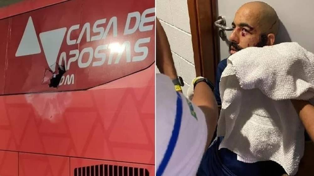 إصابة لاعبين في انفجار بحافلة فريق باهيا البرازيلي