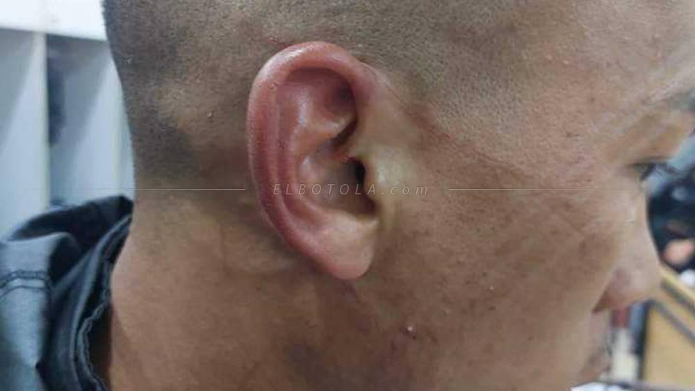 أمين رحيمي حامل أمتعة الرجاء يتعرض للاعتداء من قبل لاعبي نهضة بركان