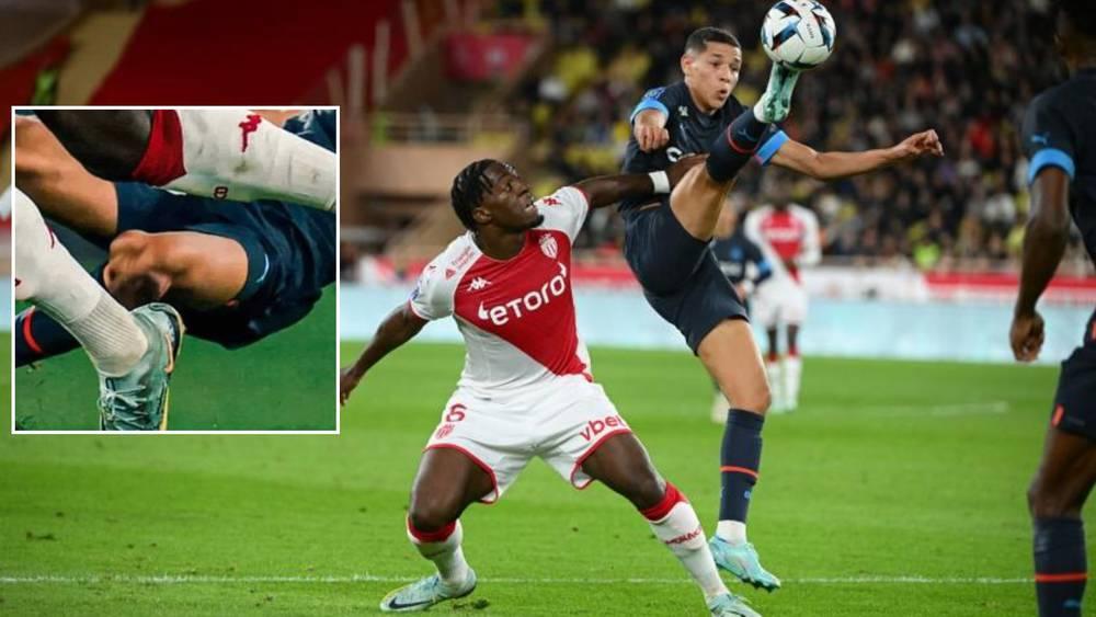 ديساسي (لاعب موناكو): "التحكيم كان لصالح مارسيليا ونحن لا نرقص إنما نلعب كرة القدم.. إنها رياضة الاحتكاك والنزالات الثنائية"