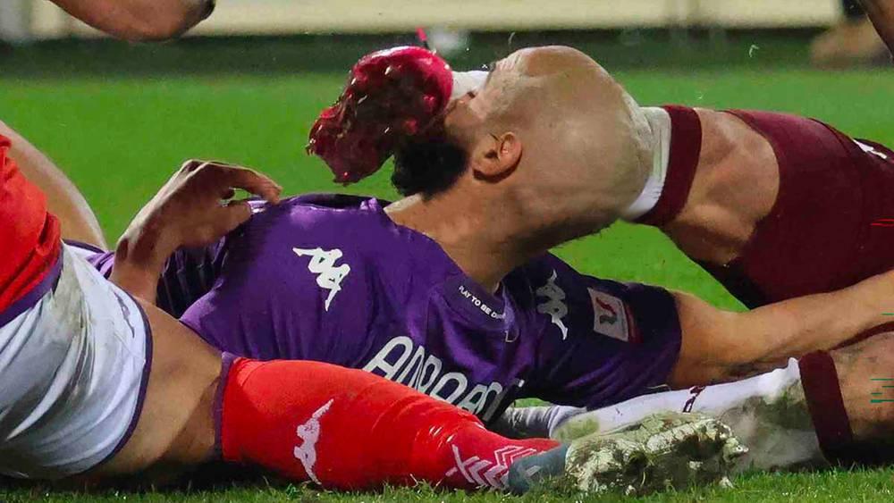 أمرابط يتلقى ضربة "قوية" في مواجهة فيورنتينا ضد تورينو ومدربه يؤكد: "لقد تعرض لكسر على مستوى الأنف"