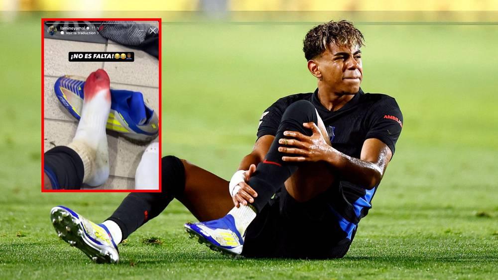 لامين يامال يثير القلق قبل مواجهة أتلتيكو مدريد في كأس الملك